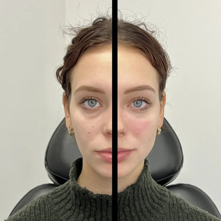 Best Laser Treatments in Chicago – Safe, Effective Results
