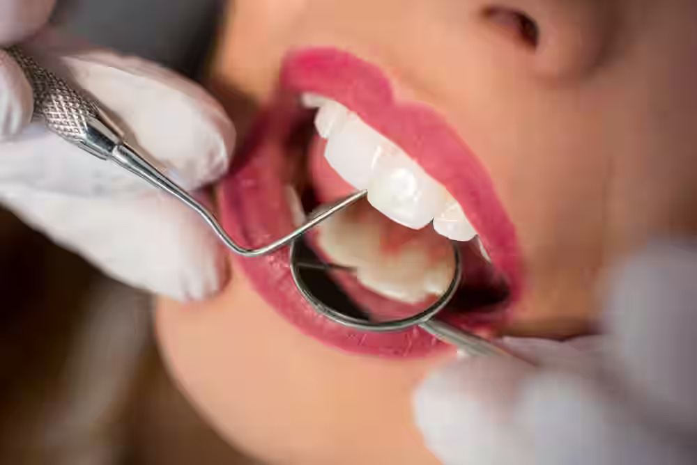 What to Expect During Wisdom Tooth Removal: A Step-by-Step Guide
