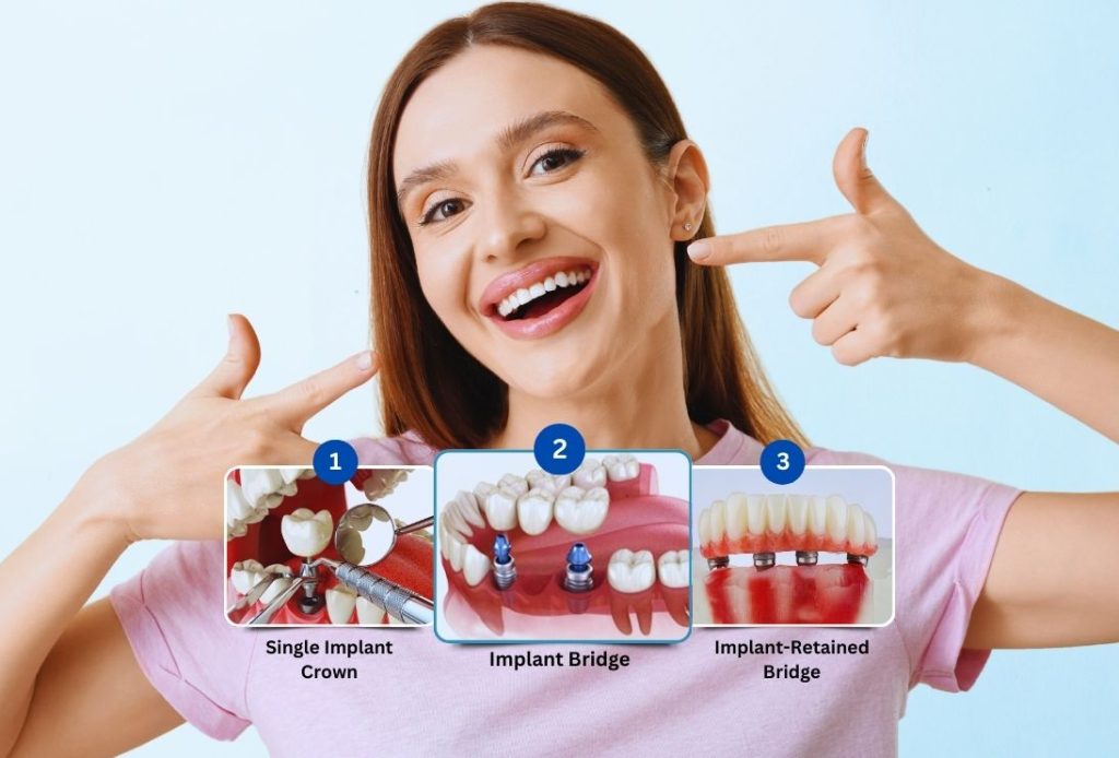 Why Dental Implant in Islamabad Is the Future of Dentistry
